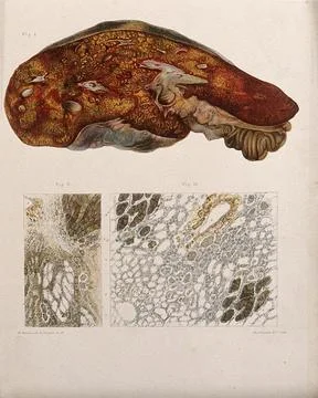 Three sections of a diseased part of the body, numbered for key. Chromolith.. Illustrazione stock