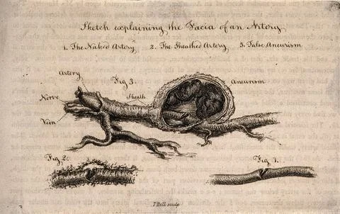 Three sections of a dissected artery, numbered for key. Etching by I. Bell,.. Stock Illustration