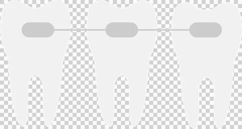 Three teeth with dental braces, aligned on a white background, representing.. Stock Illustration