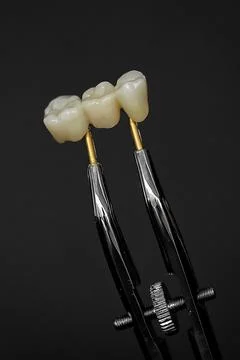 Three unit ceramic dental bridge held with laboratory tweezers Stock Photos