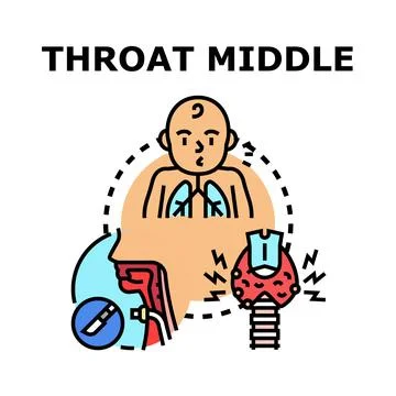 Throat middle medical problem and surgery concept Stock Illustration