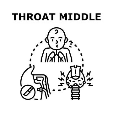 Throat middle medical problem and surgery concept Stock Illustration