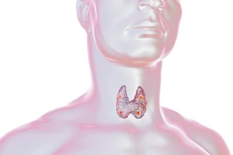 Thyroid and parathyroid glands Stock Illustration