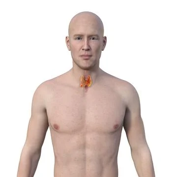 Thyroid cancer, 3D illustration Stock Illustration