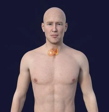 Thyroid cancer, 3D illustration Stock Illustration