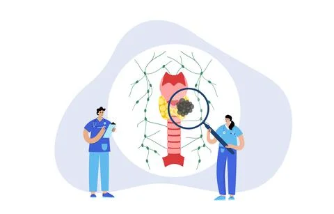 Thyroid cancer stages Stock Illustration