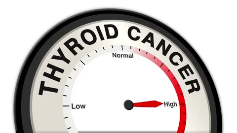 Thyroid cancer Text or Word Level Low Normal High - Barometer or Tachometer Stock Footage 308729166