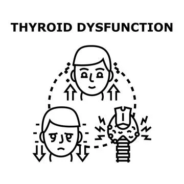 Thyroid dysfunction condition affecting health and hormone levels イラスト素材