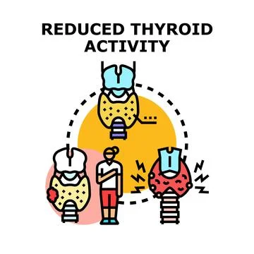 Thyroid gland activity condition causing health problems Illustration