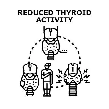 Thyroid gland activity condition causing health problems Stock Illustration