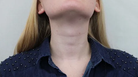 Thyroid gland. Closeup portrait of cute sick young blonde woman in white top hav Stock Footage 88149776