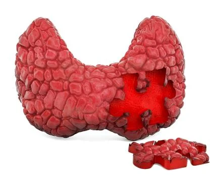 Thyroid gland disease concept, 3D rendering Stock Illustration