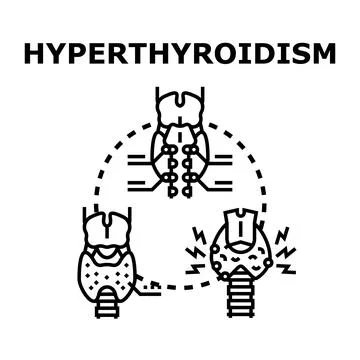 Thyroid gland experiencing hyperthyroidism with medical illustration Stock Illustration