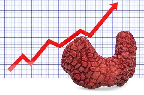 Thyroid gland with growing chart. 3D rendering Stock Illustration