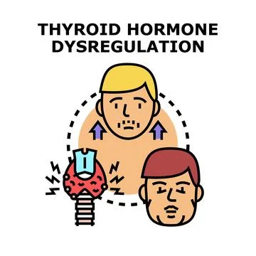 Thyroid gland hormone dysregulation causing hyperthyroidism and hypothyroid.. イラスト素材