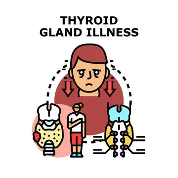 Thyroid gland illness affecting human health and endocrine system Stock Illustration