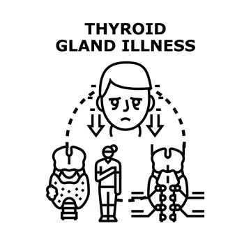 Thyroid gland illness affecting human health and endocrine system Stock Illustration