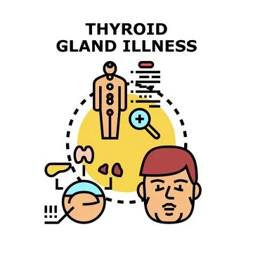Thyroid gland illness causing human body health problems Illustrazione stock