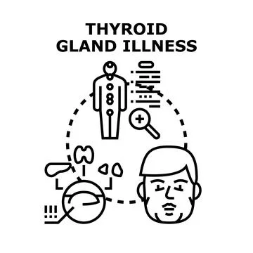Thyroid gland illness causing human body health problems Illustrazione stock