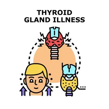 Thyroid gland illness concept vector illustration Stock Illustration
