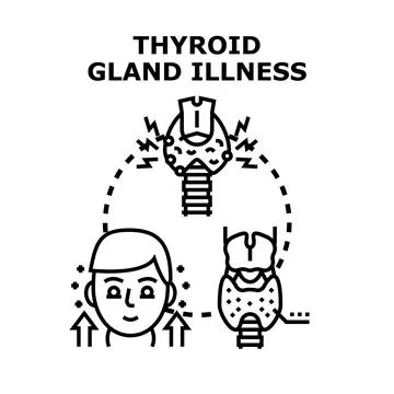 Thyroid gland illness concept vector illustration Stock Illustration