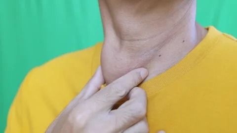 Thyroid gland inflammation at neck, goiter, throat cancer, sore throat Stock Footage 328208121