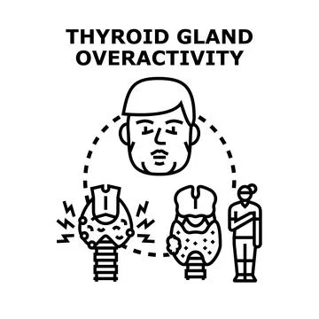 Thyroid gland overactivity causing health problems concept Stock Illustration