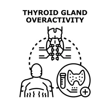 Thyroid gland overactivity leading to hyperthyroidism symptoms Stock Illustration