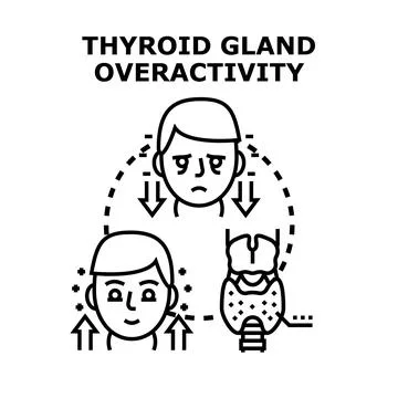 Thyroid gland overactivity vector illustration showing hyperthyroidism sympto Stock Illustration