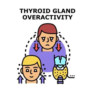 Thyroid gland overactivity vector illustration showing hyperthyroidism sympto Stock Illustration