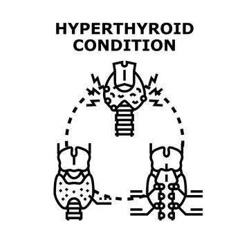 Thyroid gland suffering hyperthyroid condition illustration Stock Illustration