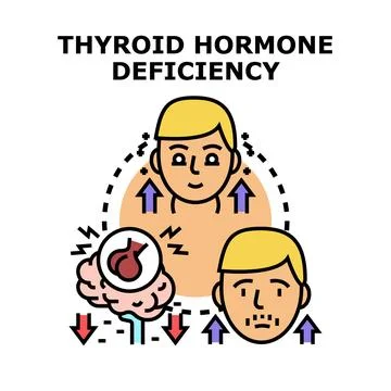 Thyroid hormone deficiency concept vector illustration Stock Illustration