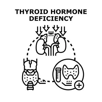 Thyroid hormone deficiency concept vector illustration Stock Illustration