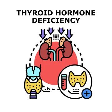 Thyroid hormone deficiency concept vector illustration Stock Illustration