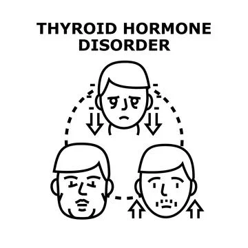 Thyroid hormone disorder symptoms vector illustration Stock Illustration