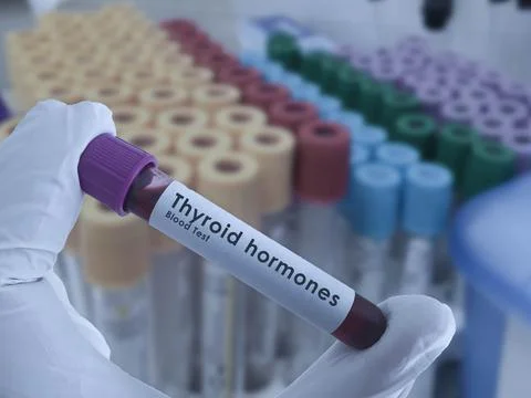 Thyroid hormone test Stock Photos