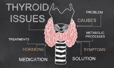 Thyroid Issues on Blackboard Illustrazione stock