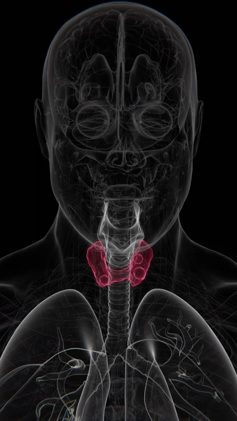 Thyroid nodules are abnormal lumps or growths within the thyroid gland that may Stock Footage 343023953