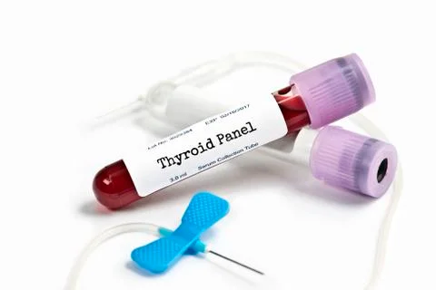 Thyroid Panel Lab Sample Stock Photos