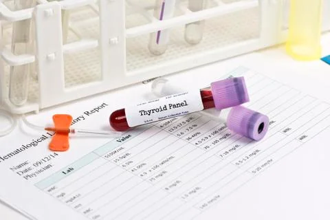 Thyroid Panel Lab Test Stock Photos
