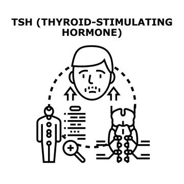 Thyroid stimulating hormone system medical test concept 스톡 일러스트