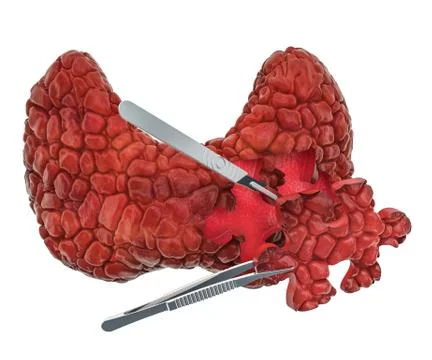 Thyroid surgery concept, 3D rendering Stock Illustration