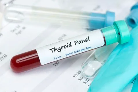 Thyroid Test Sample Stock Photos