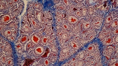 Thyroid tissue under the microscope Stock Footage 343959808