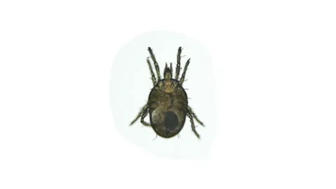 Tick acari order Trombidiformes under a microscope, superfamily Tydeoidea. Stock Footage 155495038