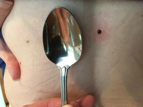 Tick in the back Foto stock