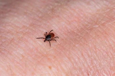 Tick bite Stock Photos