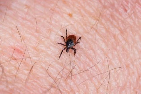Tick bite Stock Photos