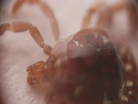 Tick Body 動画素材 77553807