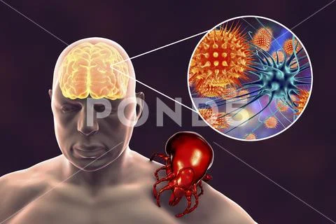 Tick-borne encephalitis concept Stock Illustration
